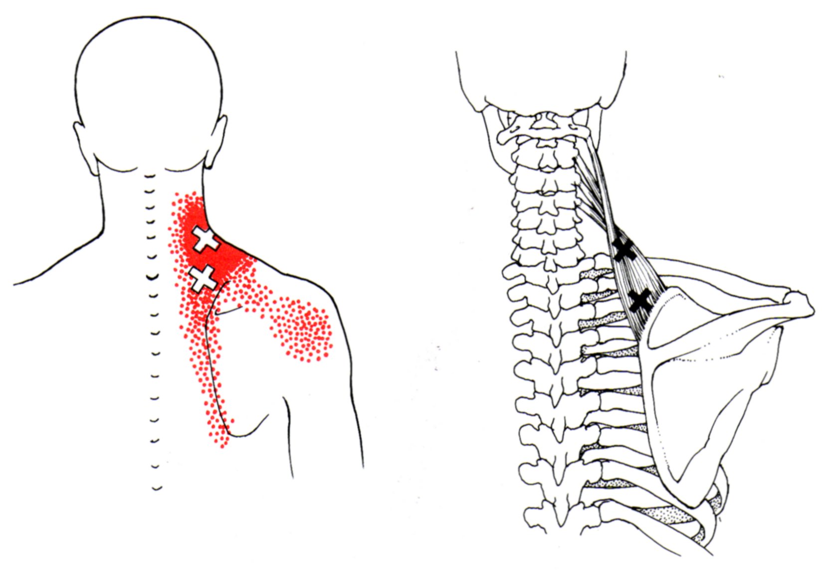Yoganatomy The Levator Scapulae Muscle Biology Diagrams